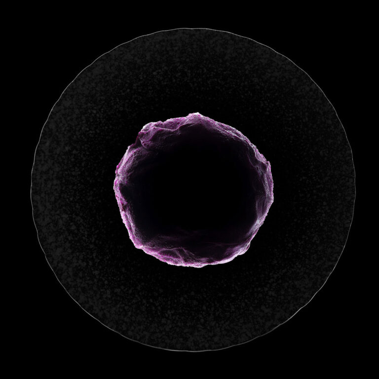 Zhang Yong - Purple-cabbage